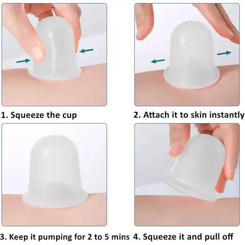 Set anticelulitic ventuze silicon pentru vacuum terapie Set de 4 ventuze pentru masaj anticelulitic prin terapie vacuum